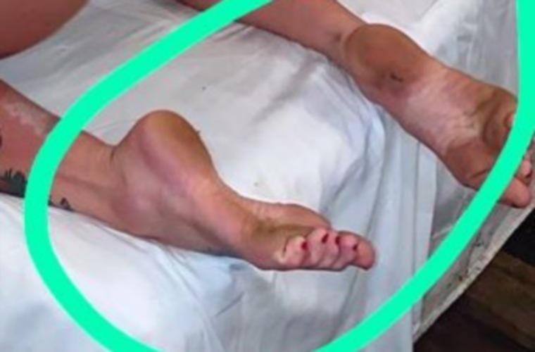 ¿Qué es OnlyFans de pies?