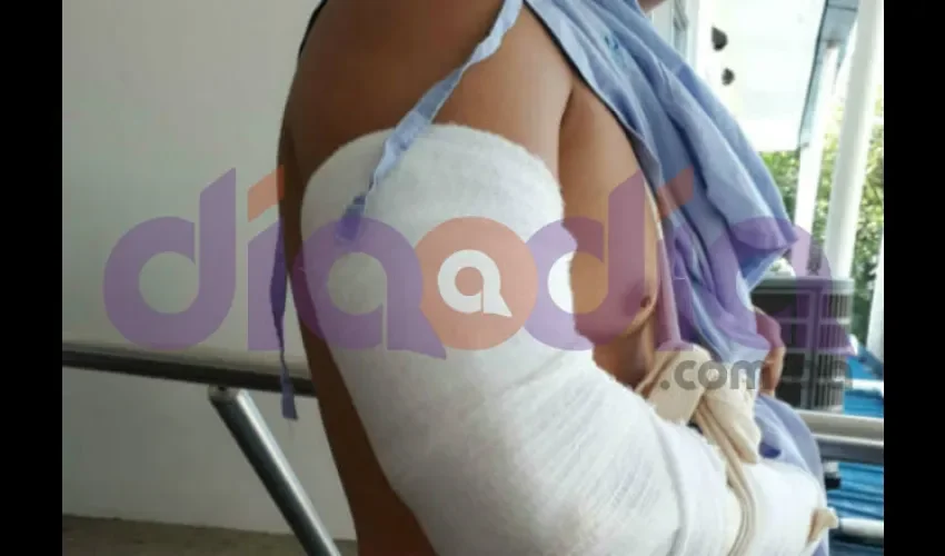 Futbolista golpeado. 