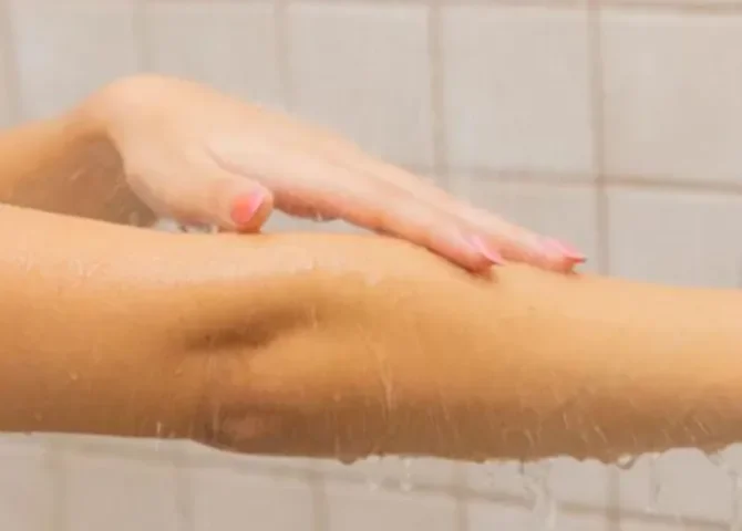  El agua clorada puede afectar tu piel 