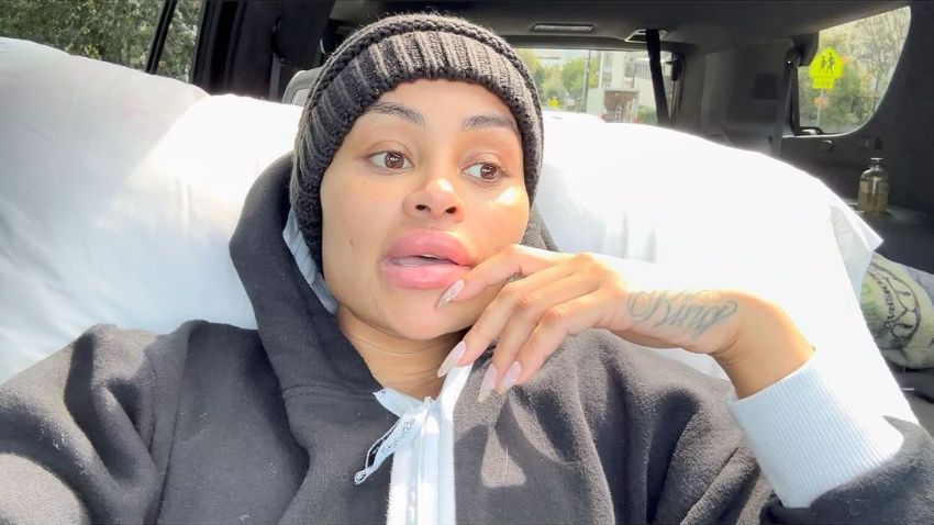 ¡Es otra persona! Blac Chyna eliminó sus rellenos faciales 