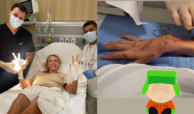 ¡Qué susto! Gaby Gnazzo termina con puntos en las manos tras accidente en su baño 
