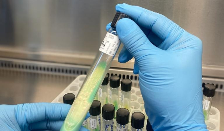 Panamá registra 1,186 casos de tuberculosis en 2025; Minsa refuerza diagnóstico y tratamiento 