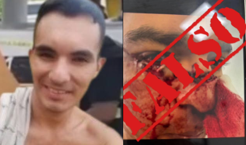 Sistema Penitenciario desmiente imagen sobre supuesto reo golpeado  