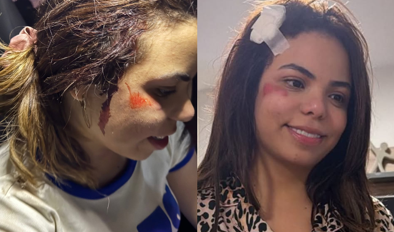 ¡Tremendo tanganazo! Susy Mouriz termina golpeada tras accidente en scooter 