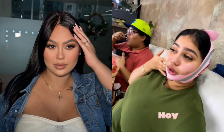 Tatiana Vélez otra vez se retoca, se hace la bichectomía y lipopapada 