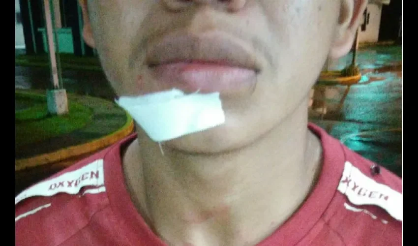 Herido 