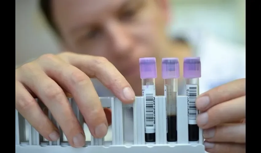 Hepatitis viral 
