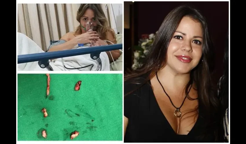 Susana