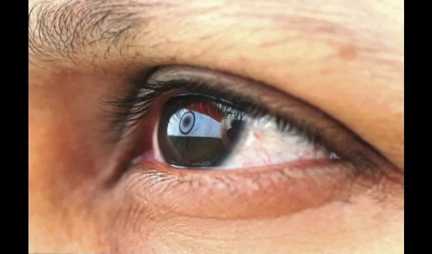 Ojo