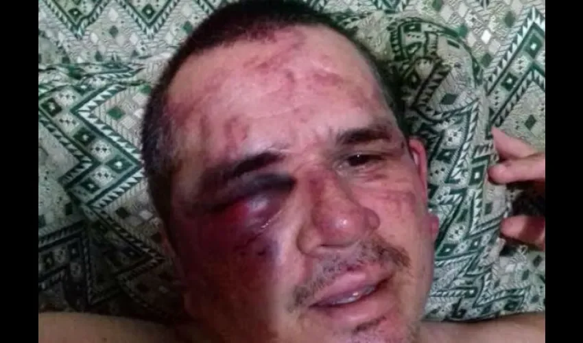 Taxista fue abandonado por los delincuentes en Panamá Oeste 