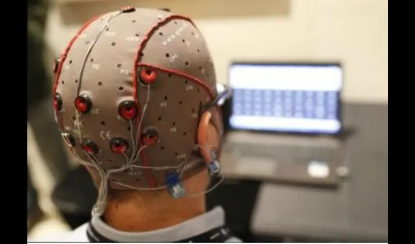 Cerebro