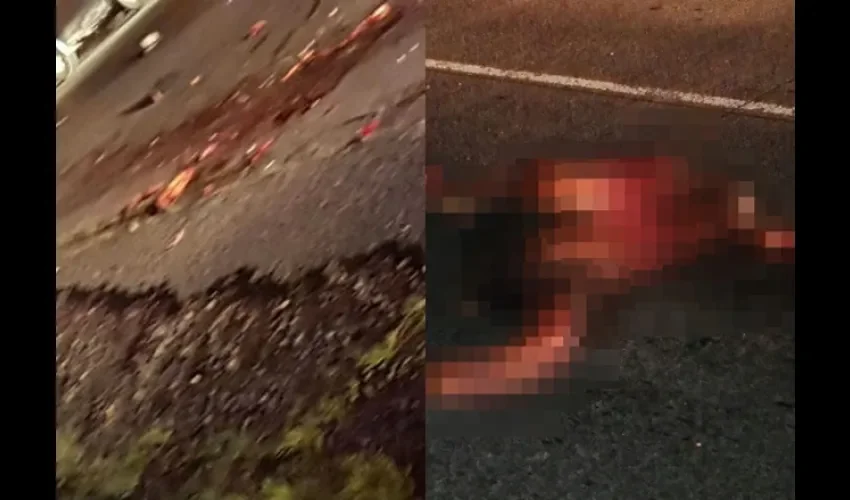  El accidente se dio en la doble vía en el paño que conduce de Concepción a la ciudad de David.