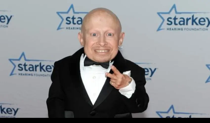 Verne Troyer era una de las personas más bajas del mundo. / Foto: Archivo