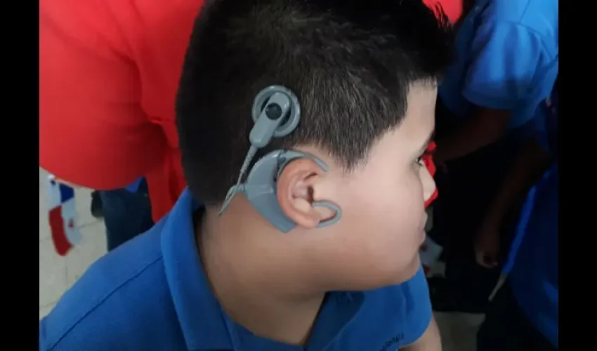 Niños con problemas de audición pueden volver a escuchar. Foto: Ilustrativa 
