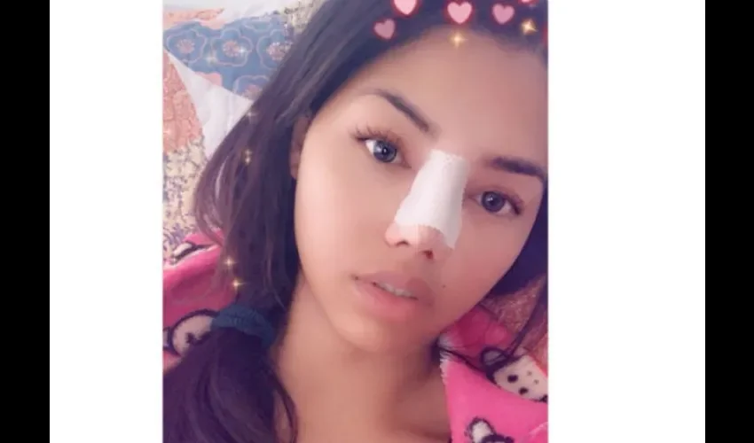 Estaba indecisa sobre operarse la nariz, pero se la hizo. Foto: Instagram