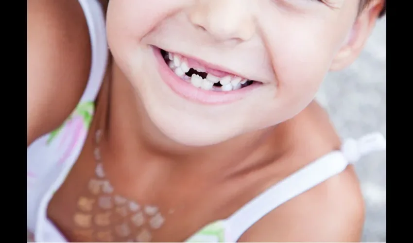 Foto ilustrativa de los dientes de una niña. Cortesía. 