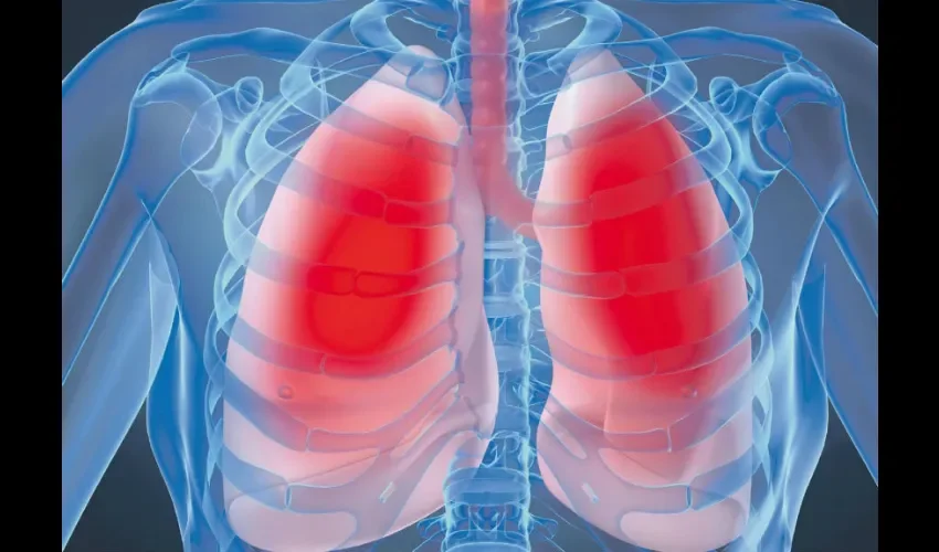 Foto ilustrativa de una imagen de los pulmones. 