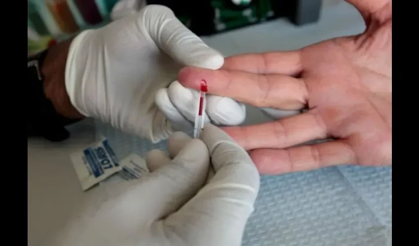 Foto ilustrativa de una prueba de VIH. 