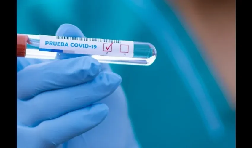 Foto ilustrativa de una prueba de coronavirus. 