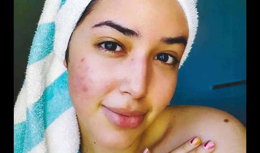 Dayana Sáez muestra su piel al natural. Foto: Instagram