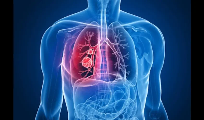 Foto ilustrativa de unos pulmones. 