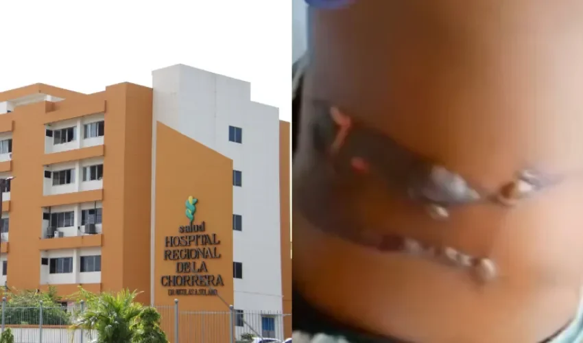 Foto: Minsa/captura de video. 