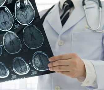 Hidrocefalia, afección que no se puede prevenir, aunque sí las causas que la producen