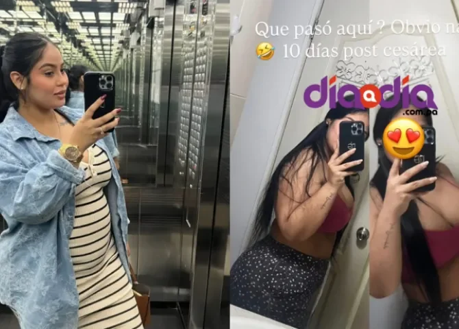  Tatiana Durango muestra con orgullo su cuerpo post cesárea 